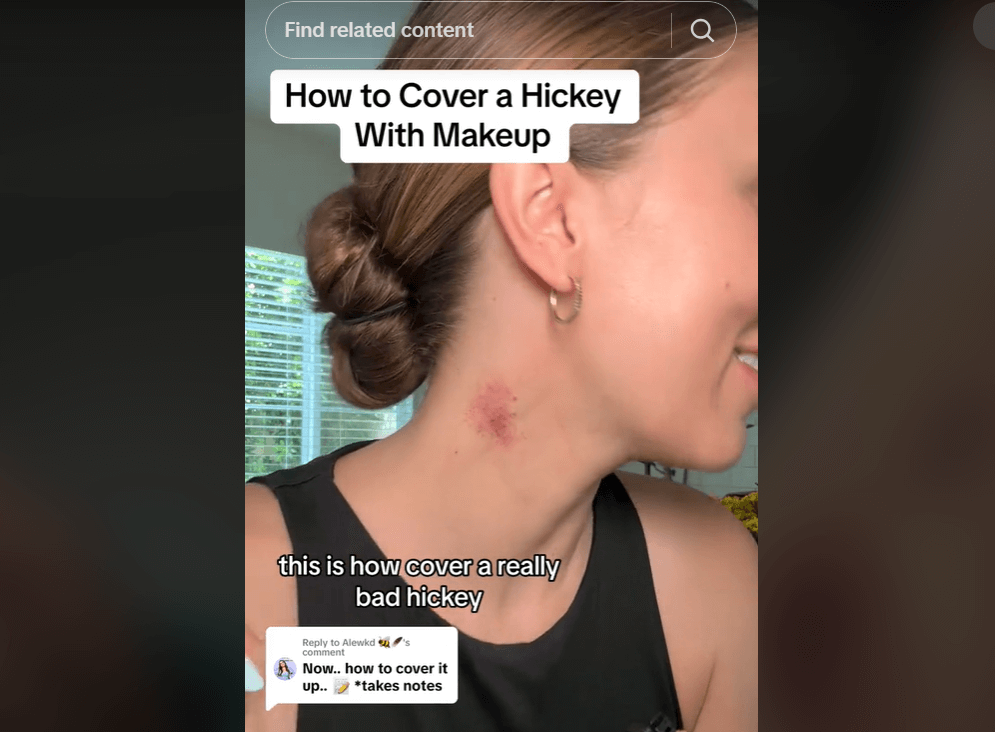 get rid of a hickey using makeup